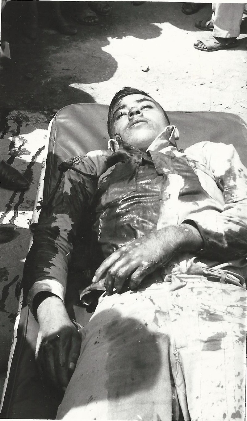 379 Cadáver guerrillero camilla